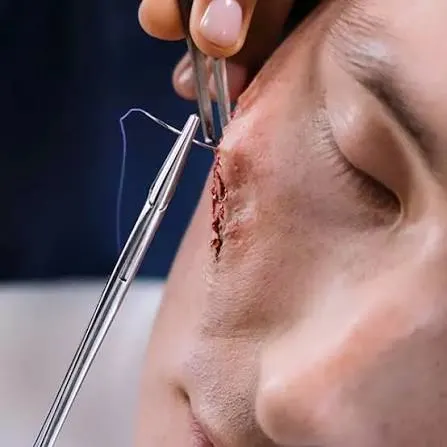 Wound Surgery